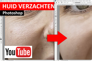 00_PS-huidverzachten.png