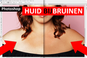 00_huid bijbruinen.png